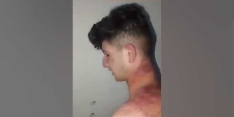 Syrian youth tortured in Lebanon